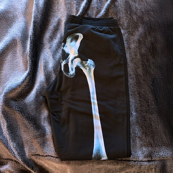 Rare 2010 Jeremy Scott Adidas Originals X-Ray Track Suit NWT Skeleton - X Large - Picture 7 of 11